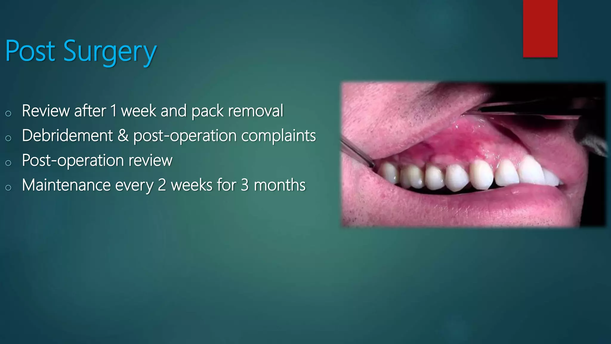 Post Surgery
o Review after 1 week and pack removal
o Debridement & post-operation complaints
o Post-operation review
o Maintenance every 2 weeks for 3 months
 