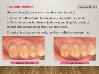 General principles of periodontal surgery | PPTX