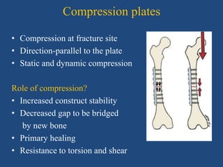 Plating principles in Orthopaedics | PPTX