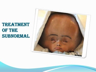 TREATMENT
OF THE
SUBNORMAL
 