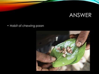 ANSWER
• Habit of chewing paan
 