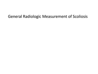 General Radiologic Measurement of Scoliosis
 