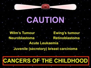 CAUTION
Wilm’s Tumour Ewing’s tumour
Neuroblastoma Retinoblastoma
Acute Leukaemia
Juvenile (secretory) breast carcinoma
CANCERS OF THE CHILDHOOD
 