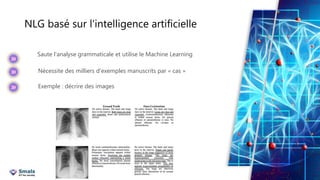 NLG basé sur l'intelligence artificielle
6
Saute l'analyse grammaticale et utilise le Machine Learning
Nécessite des milliers d'exemples manuscrits par « cas »
Exemple : décrire des images
 