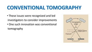 CONVENTIONAL TOMOGRAPHY
• These issues were recognized and led
investigators to consider improvements
• One such innovation was conventional
tomography
 