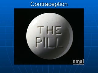 Contraception 