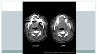 Generations and advancement of CT | PPTX