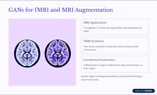 Generative AI for Synthetic Neuroimaging Data | PDF