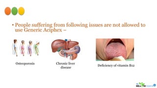 Generic Aciphex to Treat Peptic Ulcer | PPTX