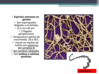  Espirales extremos en
gancho
 Son espiroquetas
delgadas y enrolladas.
 0.1 x 6 a 20 um .
 2 flagelos
periplásmicos.
 Temperatura optima de
crecimiento 28 a 30 C.
 crecen en medios de
cultivo con vitaminas
del complejo B.
 Son aerobios obligados.
 Son oxidasa y catalasa
positivos.
Leptospira
 