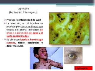 Leptospira
(Leptospira interrogans)
 Produce la enfermedad de Weil
 La infección, en el hombre se
produce por contacto directo con
tejidos del animal infectado de
orina o o por medio del agua y el
suelo contaminados.
 Se observan ictericia, hemorragia
cutánea, fiebre, escalofríos y
dolor muscular.
Leptospira
 