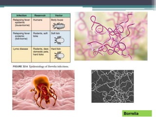 Borrelia
 