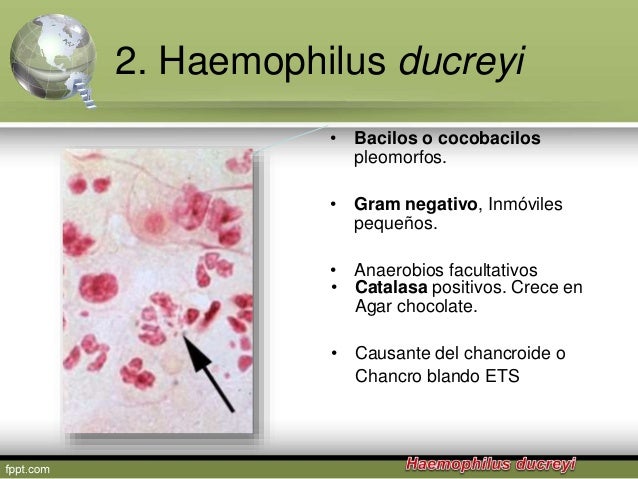 Genero haemophilus i 2015 Genero haemophilus i 2015