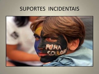 SUPORTES INCIDENTAIS
 