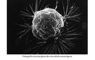 Fotografia microscópica de uma célula cancerígena. 
 