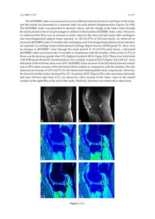 The Effect of Intra-articular Injection of Autologous Microfragmented Fat Tissue on Proteoglycan Synthesis in Patients with Knee Osteoarthritis