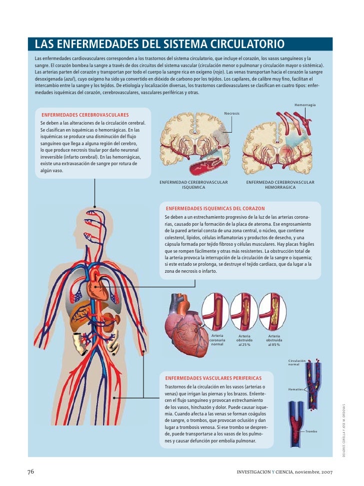genes dieta y enfermedades cardiovasculares sistema cardiovasculares