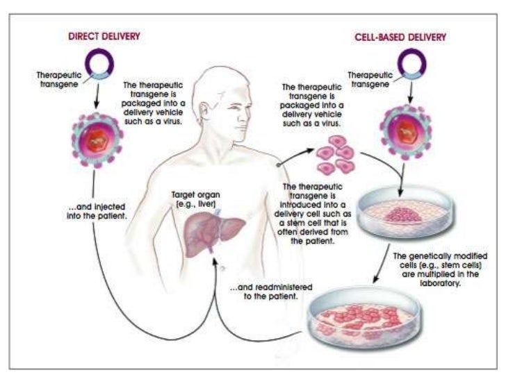 Gene therapy