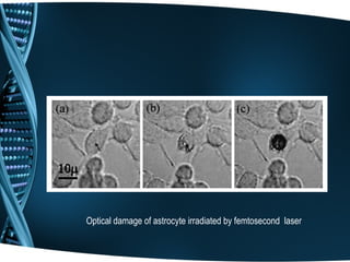 Optical damage of astrocyte irradiated by femtosecond laser
 