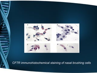 CFTR immunohistochemical staining of nasal brushing cells
 