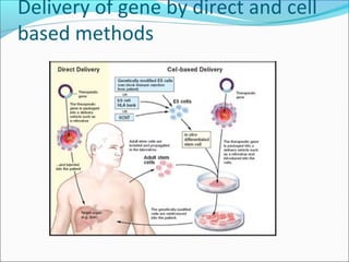Delivery of gene by direct and cell
based methods
 