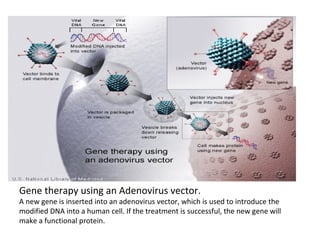 Gene therapy using an Adenovirus vector.
A new gene is inserted into an adenovirus vector, which is used to introduce the
modified DNA into a human cell. If the treatment is successful, the new gene will
make a functional protein.
 