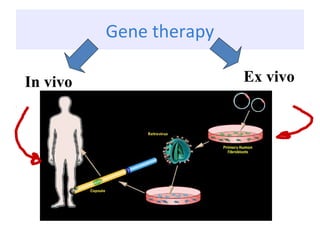 Gene therapy
In vivo Ex vivo
 