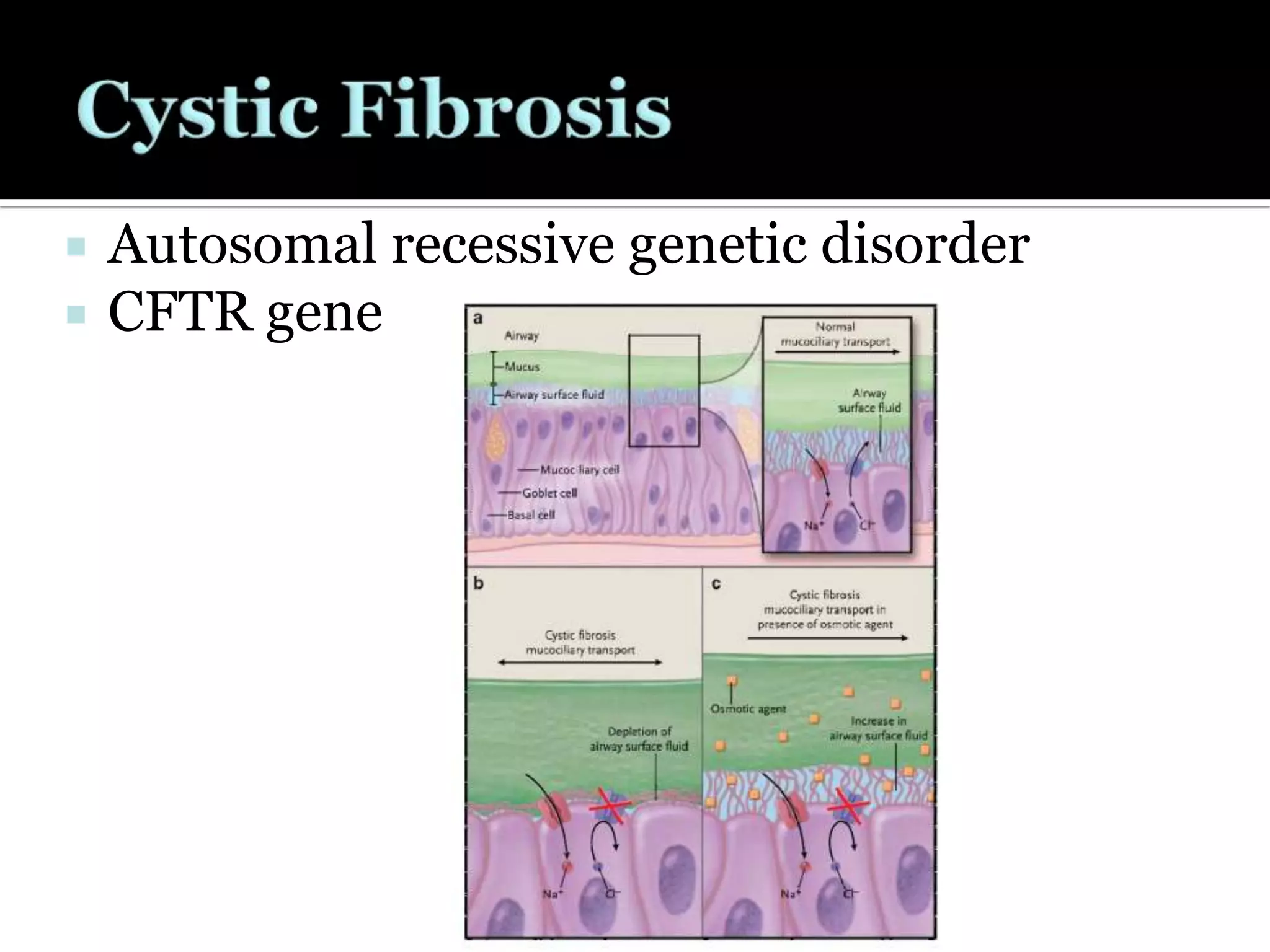 Gene Therapy For Cystic Fibrosis | PPTX