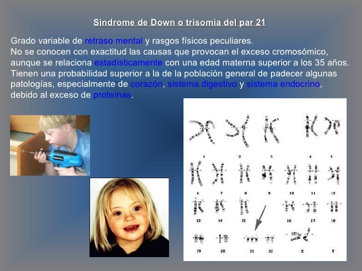 El Sindrome De Down Es Una Monosomia Y