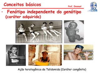 Conceitos básicos Prof. Emanuel
• Fenótipo independente do genótipo
(caráter adquirido)
Ação teratogênica da Talidomida (Caráter congênito)
 