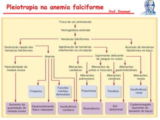 Pleiotropia na anemia falciforme
Prof. Emanuel
 