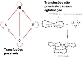 Transfusões
possíveis
Transfusões não
possíveis causam
aglutinação
 