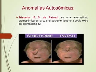 Anomalías Autosómicas:
 Trisomía 13 S. de Pataud: es una anormalidad
cromosómica en la cual el paciente tiene una copia e...