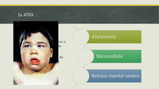Sx ATRX
• Recesivo Cromosoma X
• Codifica proteínas similares a
SWI/SNF (remodelador de
cromatina)
• Puede que sea miembro de
genes represores (HDAC)
αTalasemia
Microcefalia
Retraso mental severo
 