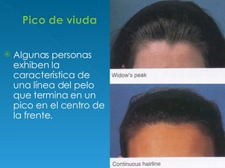 Algunas personas exhiben la característica de una línea del pelo que termina en un pico en el centro de la frente. 