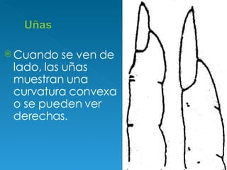 Cuando se ven de lado, las uñas muestran una curvatura convexa o se pueden ver derechas.  