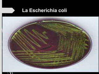 La Escherichia coli
 
