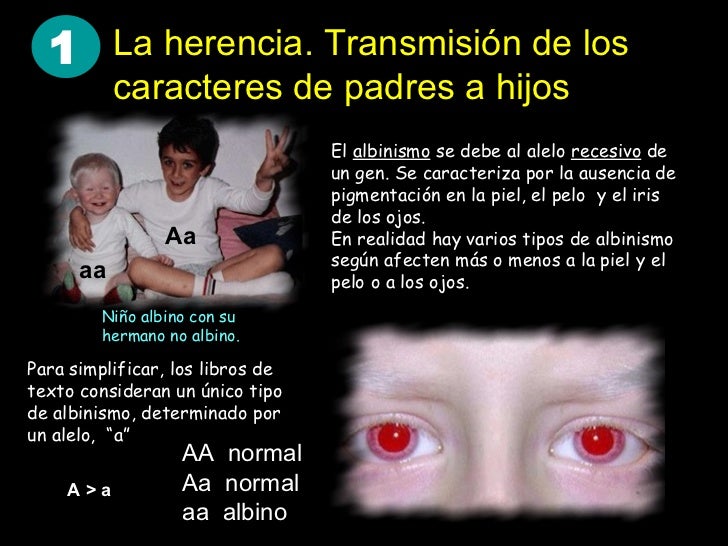 Las manchas de pigmento sobre la persona esconder