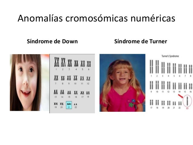 Genetica humana