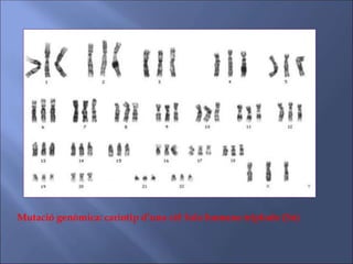 Mutació genòmica: cariotip d’una cèl·lula humana triplode (3n)
 