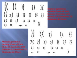 Mutació genòmica:
cariotip d’una cèl·lula
humana masculina amb
trisomia al cromosoma 21:
Síndrome de Down
Mutació genòmica:
cariotip d’una cèl·lula
humana femenina amb
trisomia al cromosoma 21:
Síndrome de Down
 