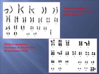 Mutació genòmica:
Síndrome de Turner: 44
autosomes + X
Mutació genòmica:
Síndrome de Klinefelter
44 autosomes+XXY
 