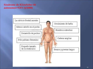 48
Síndrome de Klinefelter 44
autosomes+XXY (1/1000)
 