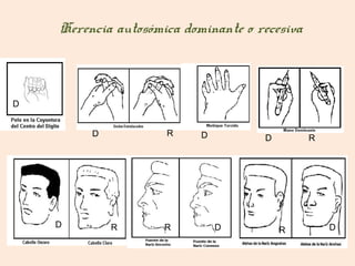 Herencia autosómica dominante o recesiva



D


         D           R     D         D         R




    D        R       R         D                   D
                                         R
 