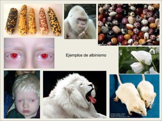 Ejemplos de albinismo
 