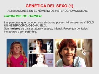 GENÉTICA DEL SEXO (1)
ALTERACIONES EN EL NÚMERO DE HETEROCROMOSOMAS.
SINDROME DE TURNER
Las personas que padecen este síndrome poseen 44 autosomas Y SOLO
UN HETEROCROMOSOMA, EL X.
Son mujeres de baja estatura y aspecto infantil. Presentan genitales
inmaduros y son estériles.
 