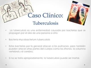 Caso Clínico:
Tuberculosis
• La tuberculosis es una enfermedad causada por bacterias que se
propagan por el aire de una persona a otra
• Bacteria Mycobacterium tuberculosis
• Estas bacterias por lo general atacan a los pulmones, pero también
pueden atacar otras partes del cuerpo como los riñones, la columna
vertebral y el cerebro.
• Si no se trata apropiadamente, la tuberculosis puede ser mortal.
 
