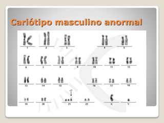 Cariótipo masculino anormal
 