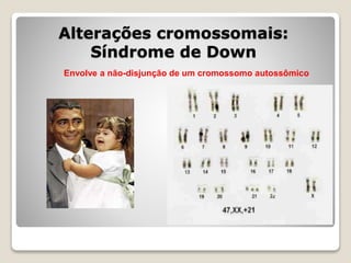 Alterações cromossomais:
Síndrome de Down
Envolve a não-disjunção de um cromossomo autossômico
 