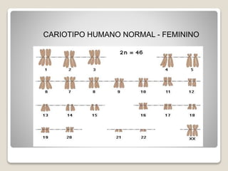 CARIOTIPO HUMANO NORMAL - FEMININO
 
